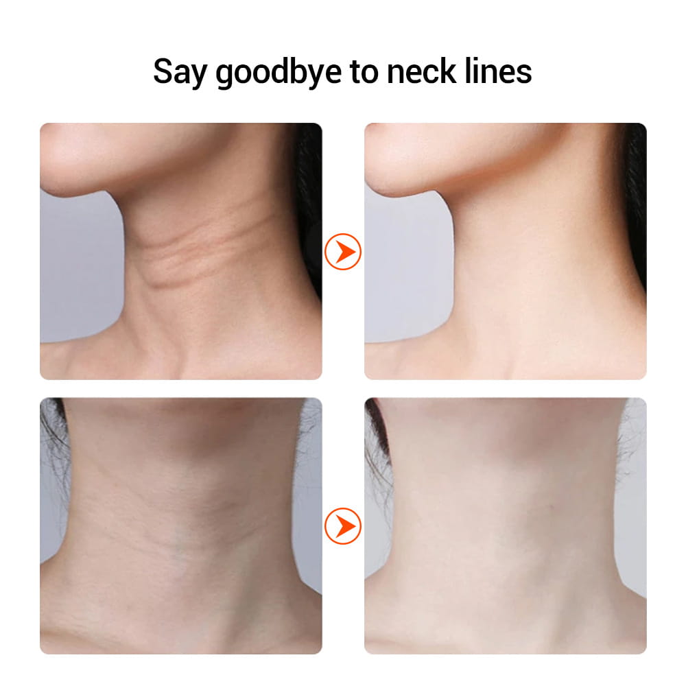 Before and after results of Color Light Therapy Neck and Facial Beauty Device treatment.