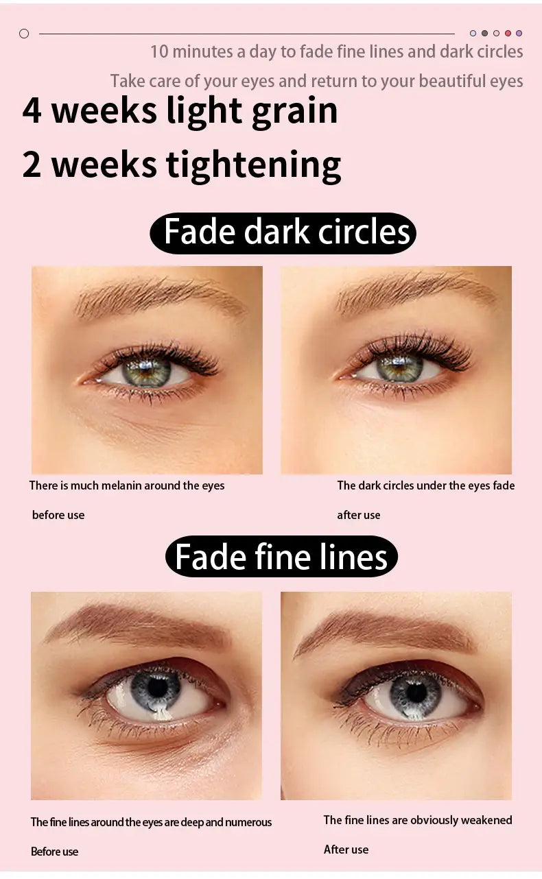 Comparison of eye areas showing dark circles and fine lines treated by Avy’s LED Eye Massager.