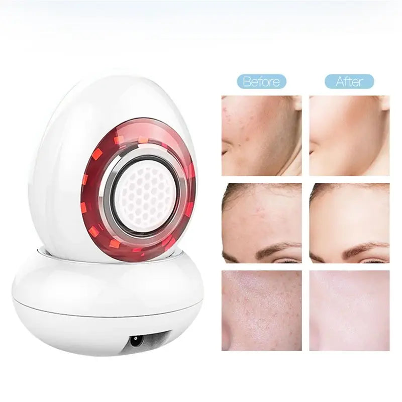 Radio Frequency Facial Care Machine with LED Photon Rejuvenation