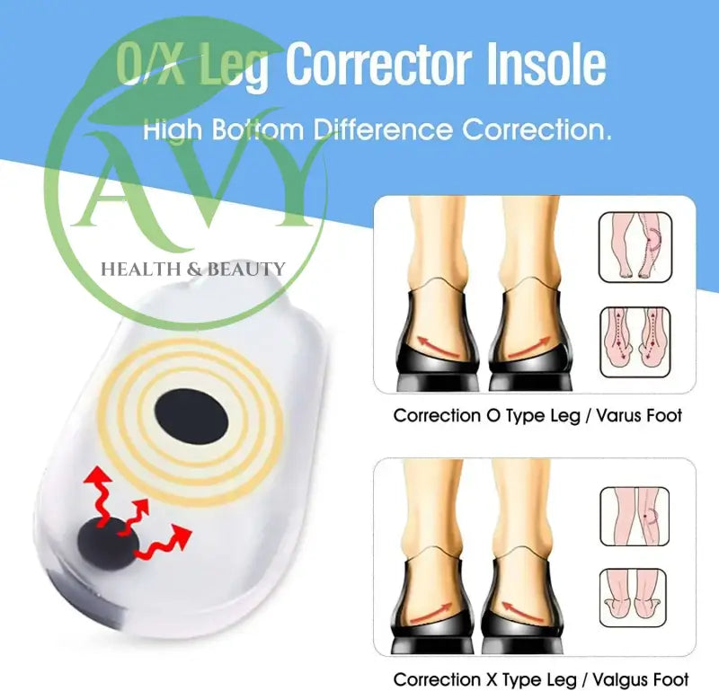 Orthotic Insoles for Correcting O and X-Legs: Supports Knee Alignment for Men and Women