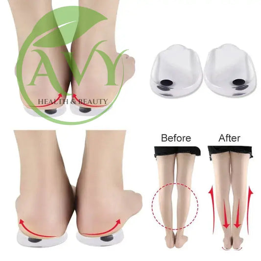 Orthotic Insoles for Correcting: Supports Knee Alignment for Men and Women - Image #1