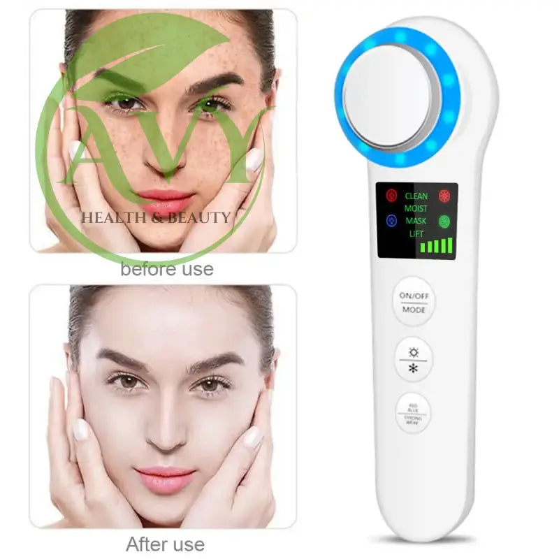 Ultimate Spa Experience: Professional Facial Lifting Vibration Massager with Hot/Cold Hammer and Ultrasonic Cryotherapy - Image #1